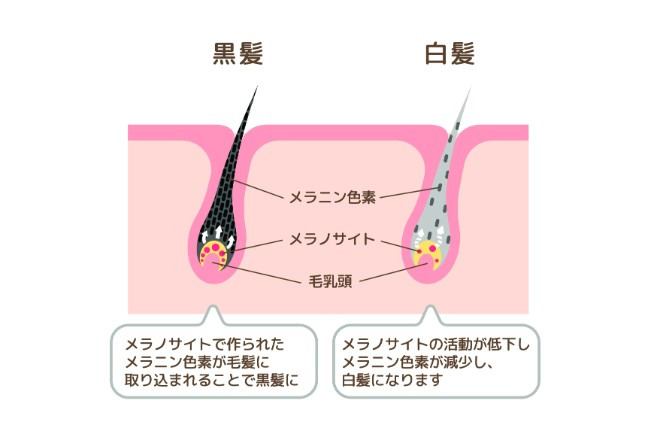 30代で急に白髪が増える5つの原因